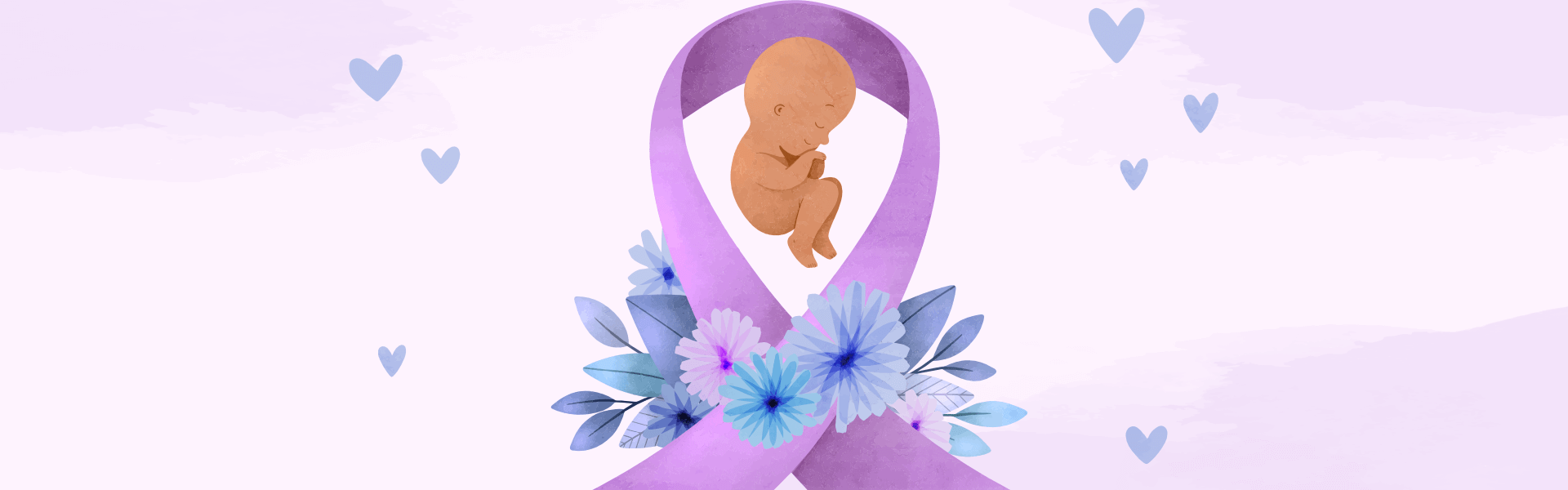 Newborn Umbilical Cord Care Newborn Umbilical Cord Care
